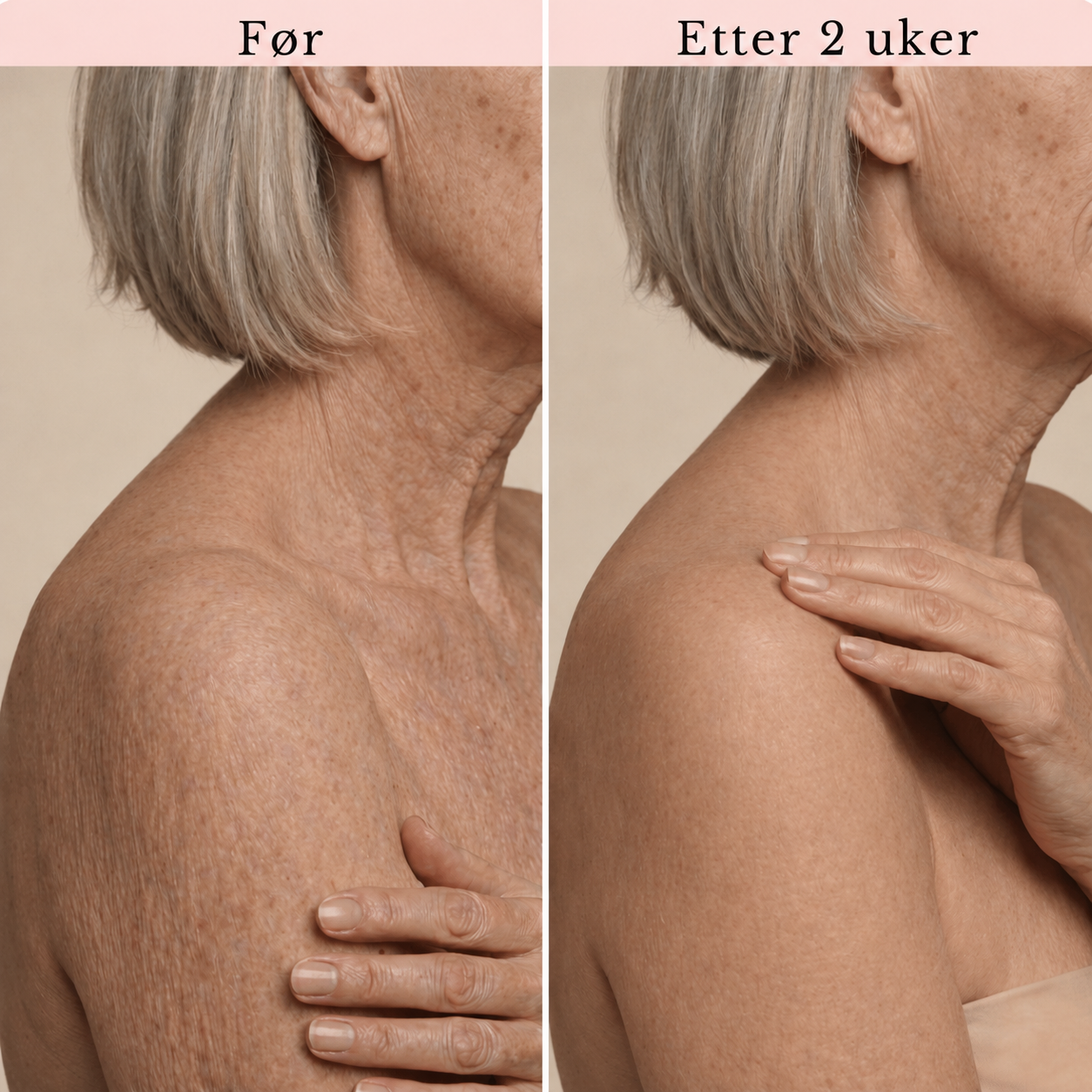 PureDerm Retinol Body Lotion